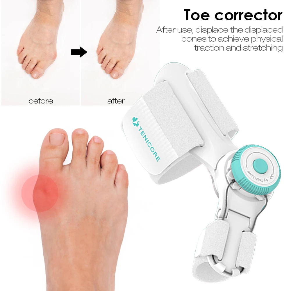 Bunion Splint Big Toe Straightener Bunion Corrector for Woman Men Knob Hallux Valgus Correction Orthopedic Pedicure Foot Care